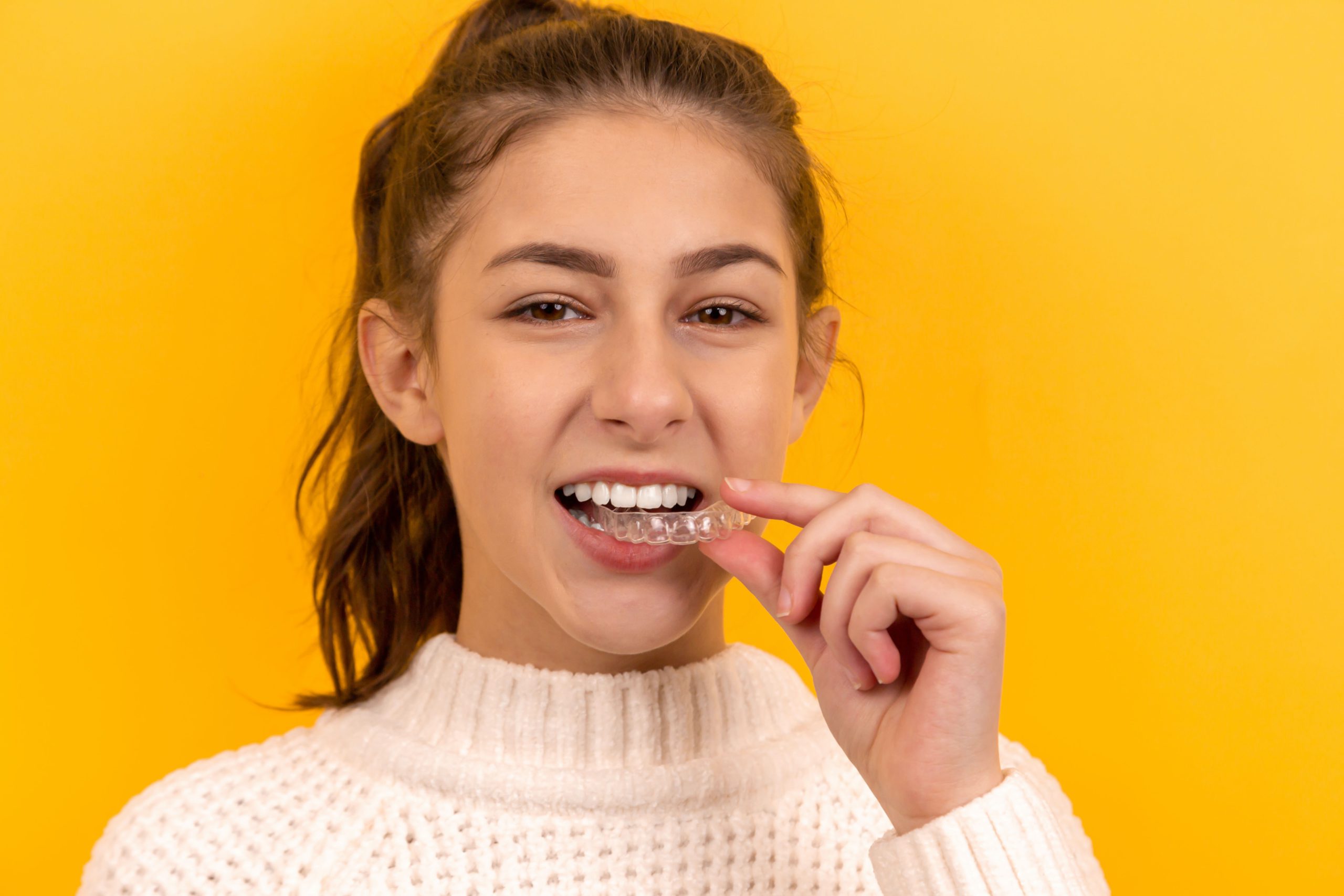 best invisible braces (Clear Aligners)